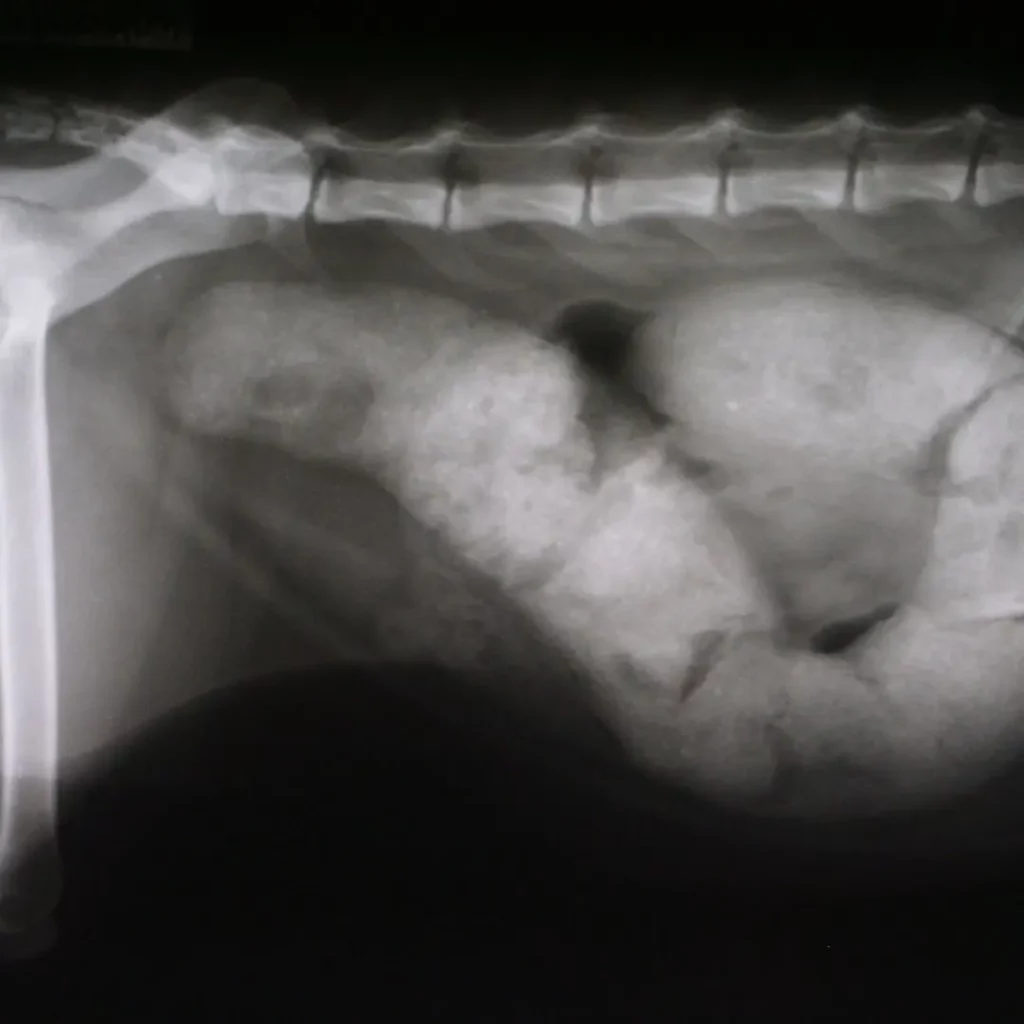 an x-ray of constipated person